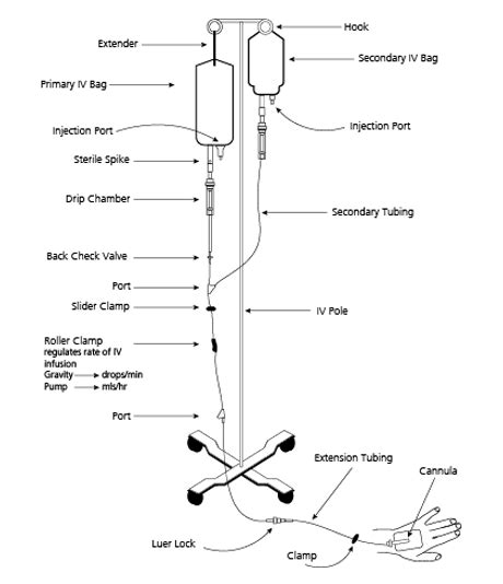  iv|Intravenous injection: Uses, equipment, sites, and more